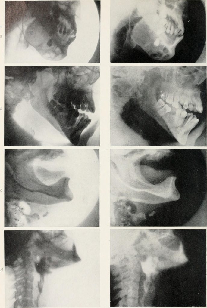 Radiography_Xray_therapeutics_and_radium_therapy_1916_14571637228