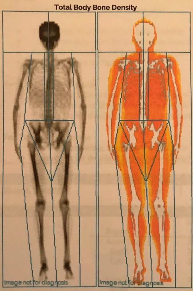 Asymmetry bodies
